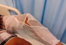 Kaki Anak di Cilegon Melepuh Diduga Akibat Bom Molotov, Kasusnya Ditangani Polisi Korban Bom Molotov