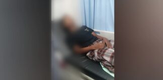 Luka Bakar 30 Persen Akibat Diduga Bom Molotov, Keluarga Korban Soroti Minimnya Perhatian Pemkot Cilegon Luka Bakar